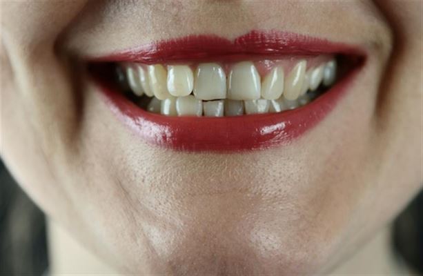 Tandpleje for voksne: Forebyggelse og behandling af huller i tænder